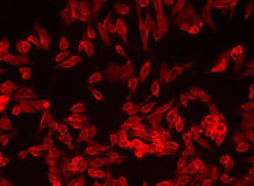 Fluorescence Microscopy - Cell Plasma Membrane Staining Kit - Orange Fluorescence - Cytopainter (AB219941)