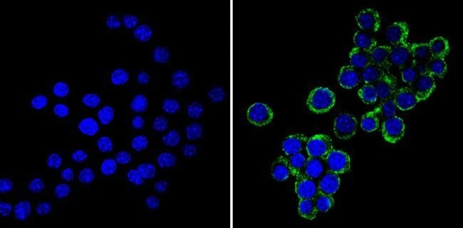 Immunocytochemistry/ Immunofluorescence - Anti-Cellubrevin antibody (AB5789)