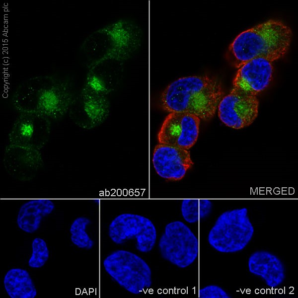 Immunocytochemistry/ Immunofluorescence - Anti-Cellubrevin antibody [EPR16866] (AB200657)