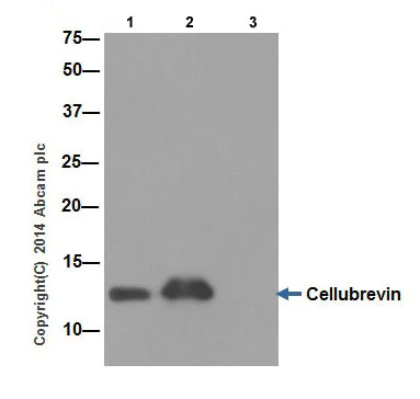 Immunoprecipitation - Anti-Cellubrevin antibody [EPR16866] (AB200657)