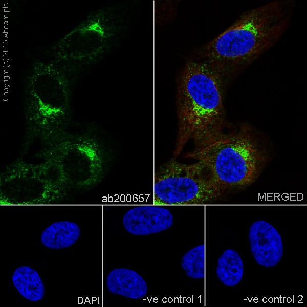 Immunocytochemistry/ Immunofluorescence - Anti-Cellubrevin antibody [EPR16866] - BSA and Azide free (AB251315)