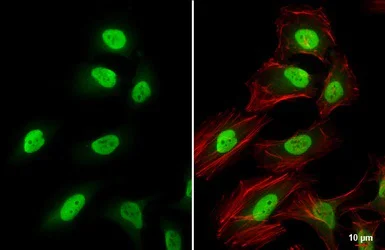 Immunocytochemistry/ Immunofluorescence - Anti-Cellular Apoptosis Susceptibility/CSE1L antibody (AB96755)