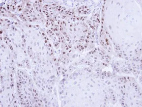 Immunohistochemistry (Formalin/PFA-fixed paraffin-embedded sections) - Anti-Cellular Apoptosis Susceptibility/CSE1L antibody (AB96755)