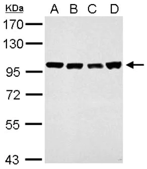 Western blot - Anti-Cellular Apoptosis Susceptibility/CSE1L antibody (AB96755)