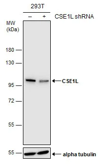 Western blot - Anti-Cellular Apoptosis Susceptibility/CSE1L antibody (AB96755)