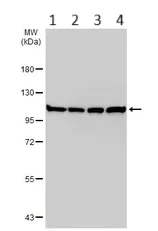 Western blot - Anti-Cellular Apoptosis Susceptibility/CSE1L antibody (AB96755)