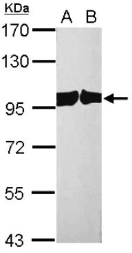Western blot - Anti-Cellular Apoptosis Susceptibility/CSE1L antibody (AB96755)