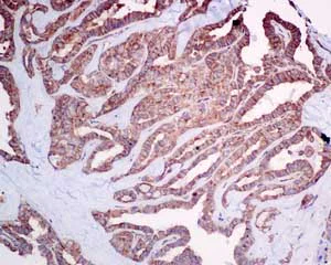 Immunohistochemistry (Formalin/PFA-fixed paraffin-embedded sections) - Anti-Cellular Apoptosis Susceptibility/CSE1L antibody [EPR10327(B)] (AB151546)