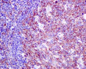Immunohistochemistry (Formalin/PFA-fixed paraffin-embedded sections) - Anti-Cellular Apoptosis Susceptibility/CSE1L antibody [EPR10327(B)] (AB151546)