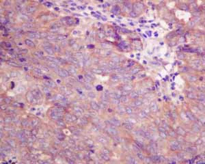 Immunohistochemistry (Formalin/PFA-fixed paraffin-embedded sections) - Anti-Cellular Apoptosis Susceptibility/CSE1L antibody [EPR10327(B)] (AB151546)