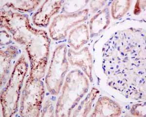 Immunohistochemistry (Formalin/PFA-fixed paraffin-embedded sections) - Anti-Cellular Apoptosis Susceptibility/CSE1L antibody [EPR10327(B)] (AB151546)