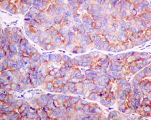 Immunohistochemistry (Formalin/PFA-fixed paraffin-embedded sections) - Anti-Cellular Apoptosis Susceptibility/CSE1L antibody [EPR10327(B)] (AB151546)
