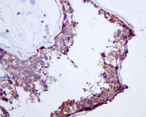 Immunohistochemistry (Formalin/PFA-fixed paraffin-embedded sections) - Anti-Cellular Apoptosis Susceptibility/CSE1L antibody [EPR10327(B)] (AB151546)