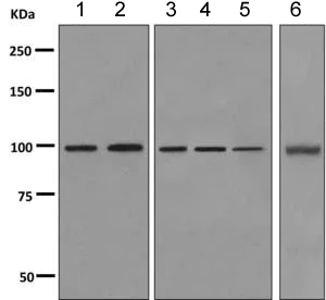 Western blot - Anti-Cellular Apoptosis Susceptibility/CSE1L antibody [EPR10327(B)] (AB151546)