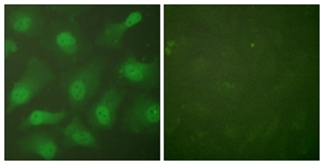 Immunocytochemistry/ Immunofluorescence - Anti-Cellular Apoptosis Susceptibility/CSE1L antibody - N-terminal (AB189180), expandable thumbnail