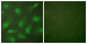 Immunocytochemistry/ Immunofluorescence - Anti-Cellular Apoptosis Susceptibility/CSE1L antibody - N-terminal (AB189180)