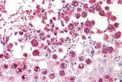 Immunohistochemistry (Formalin/PFA-fixed paraffin-embedded sections) - Anti-Cellular Apoptosis Susceptibility/CSE1L antibody - N-terminal (AB189180), expandable thumbnail