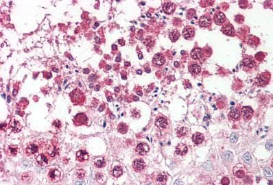 Immunohistochemistry (Formalin/PFA-fixed paraffin-embedded sections) - Anti-Cellular Apoptosis Susceptibility/CSE1L antibody - N-terminal (AB189180)