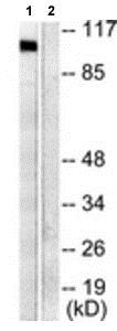 Western blot - Anti-Cellular Apoptosis Susceptibility/CSE1L antibody - N-terminal (AB189180), expandable thumbnail