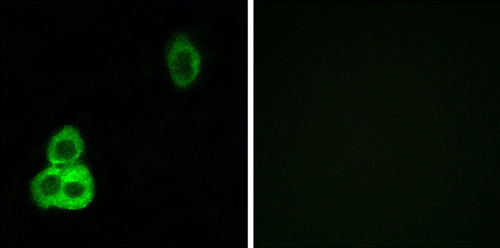 Immunocytochemistry/ Immunofluorescence - Anti-CELSR1 antibody (AB196600)