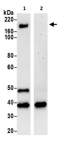 Immunoprecipitation - Anti-CELSR1 antibody (AB225889)