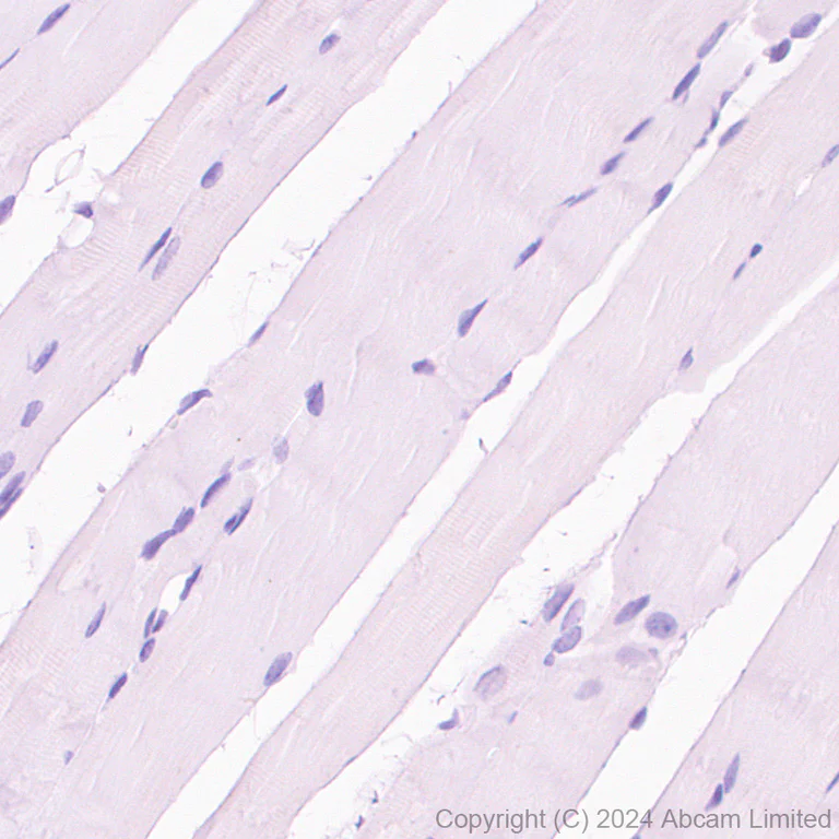 Immunohistochemistry (Formalin/PFA-fixed paraffin-embedded sections) - Anti-CELSR1 antibody [EPR26770-192] (AB322043)