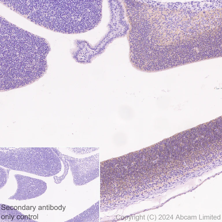 Immunohistochemistry (Formalin/PFA-fixed paraffin-embedded sections) - Anti-CELSR1 antibody [EPR26770-192] (AB322043)