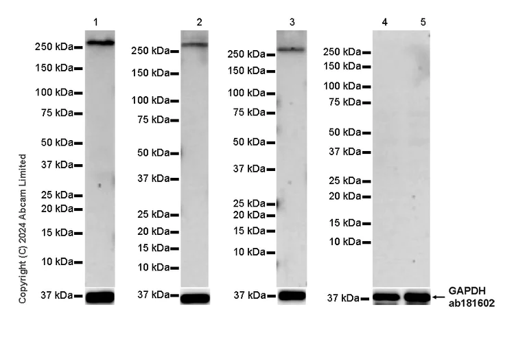 Western blot - Anti-CELSR1 antibody [EPR26770-192] (AB322043)