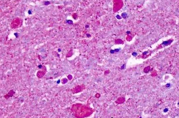 Immunohistochemistry (Formalin/PFA-fixed paraffin-embedded sections) - Anti-CELSR2 antibody - N-terminal (AB189045)
