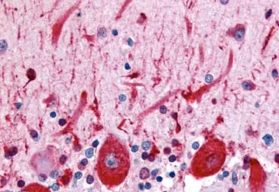 Immunohistochemistry (Formalin/PFA-fixed paraffin-embedded sections) - Anti-CELSR3 antibody - N-terminal (AB189012)
