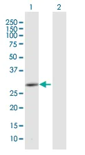 Western blot - Anti-CEMP1 antibody (AB169514)