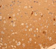 Immunohistochemistry (Formalin/PFA-fixed paraffin-embedded sections) - Anti-CEND1 antibody [EPR3738] - BSA and Azide free (AB247541), expandable thumbnail