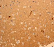 Immunohistochemistry (Formalin/PFA-fixed paraffin-embedded sections) - Anti-CEND1 antibody [EPR3738] - BSA and Azide free (AB247541)