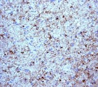 Immunohistochemistry (Formalin/PFA-fixed paraffin-embedded sections) - Anti-CEND1 antibody [EPR3739] (AB113076)
