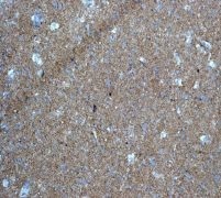 Immunohistochemistry (Formalin/PFA-fixed paraffin-embedded sections) - Anti-CEND1 antibody [EPR3739] - BSA and Azide free (AB247948)