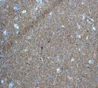 Immunohistochemistry (Formalin/PFA-fixed paraffin-embedded sections) - Anti-CEND1 antibody [EPR3739] - BSA and Azide free (AB247948)