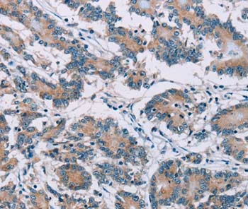 Immunohistochemistry (Formalin/PFA-fixed paraffin-embedded sections) - Anti-Cenexin1/ODF2 antibody (AB198189)