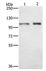 Western blot - Anti-Cenexin1/ODF2 antibody (AB198189)