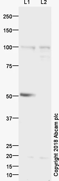Western blot - Anti-Cenexin1/ODF2 antibody (AB43840)