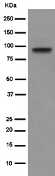 Western blot - Anti-Cenexin1/ODF2 antibody [EPR13561] (AB186412), expandable thumbnail