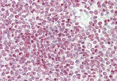 Immunohistochemistry (Formalin/PFA-fixed paraffin-embedded sections) - Anti-CENP-W antibody - N-terminal (AB189957)