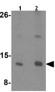 Western blot - Anti-CENP-W antibody - N-terminal (AB189957)