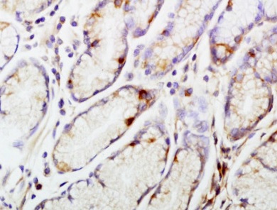 Immunohistochemistry (Formalin/PFA-fixed paraffin-embedded sections) - Anti-CENPA antibody (AB217622)