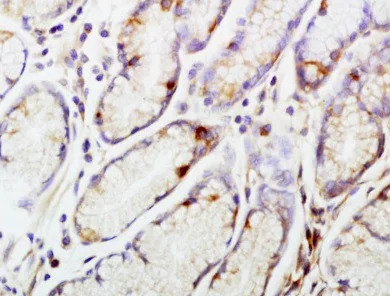 Immunohistochemistry (Formalin/PFA-fixed paraffin-embedded sections) - Anti-CENPA antibody (AB217622)