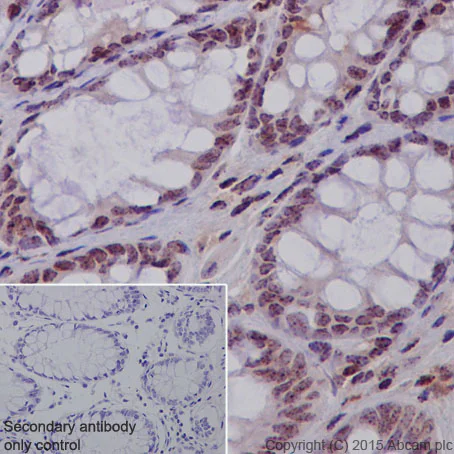 Immunohistochemistry (Formalin/PFA-fixed paraffin-embedded sections) - Anti-CENPA antibody [EP800Y] - BSA and Azide free (AB284686)