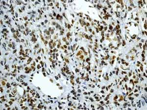 Immunohistochemistry (Formalin/PFA-fixed paraffin-embedded sections) - Anti-CENPA antibody [EP800Y] - BSA and Azide free (AB284686)