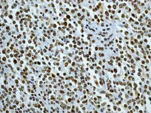 Immunohistochemistry (Formalin/PFA-fixed paraffin-embedded sections) - Anti-CENPA antibody [EP800Y] - BSA and Azide free (AB284686)