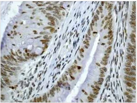 Immunohistochemistry (Formalin/PFA-fixed paraffin-embedded sections) - Anti-CENPA antibody [EP800Y] - BSA and Azide free (AB284686)