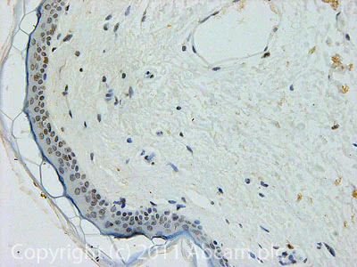 Immunohistochemistry (Formalin/PFA-fixed paraffin-embedded sections) - Anti-CENPA antibody [EP800Y] - BSA and Azide free (AB284686)