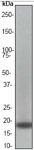 Western blot - Anti-CENPA antibody [EP800Y] - BSA and Azide free (AB284686)